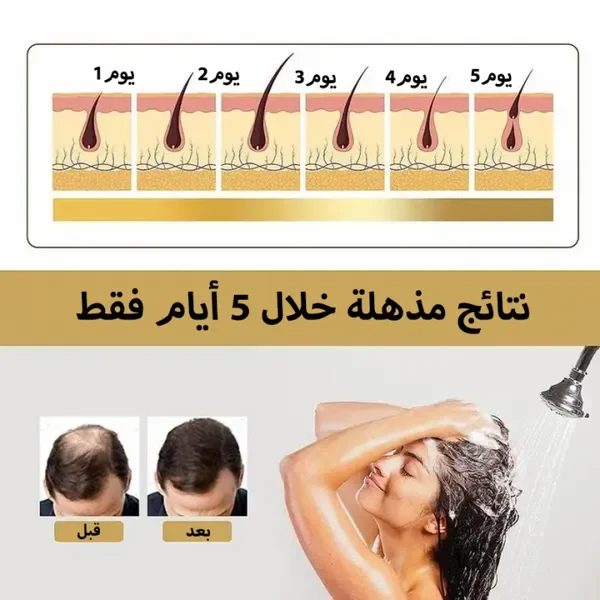 غسل الشعر بالشامبو ونتائجه على فروة الرأس